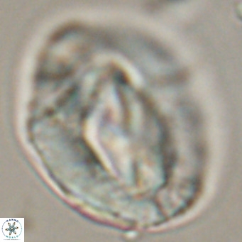 Helicosphaerella compacta VR 32692