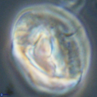 Helicosphaerella compacta VR 32693