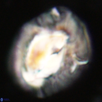 Helicosphaerella compacta VR 32704