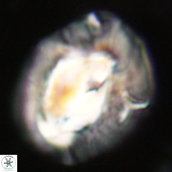 Helicosphaerella compacta VR 32704