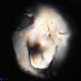 Helicosphaerella compacta VR 32705