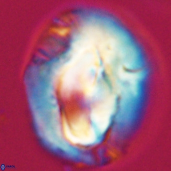 Helicosphaerella compacta VR 32706