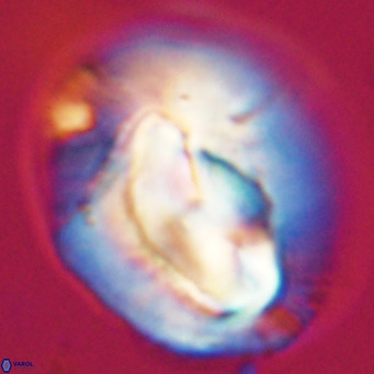 Helicosphaerella compacta VR 32707
