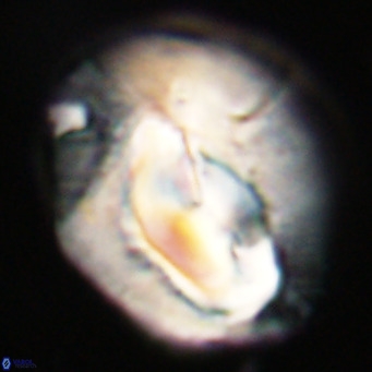 Helicosphaerella compacta VR 32708