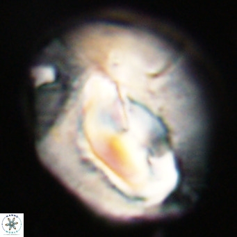 Helicosphaerella compacta VR 32708