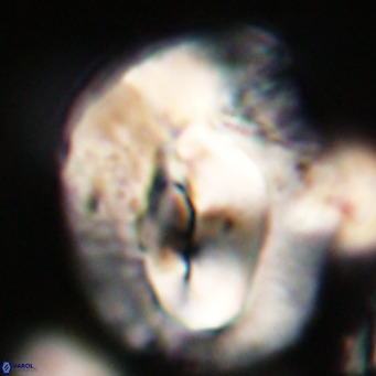 Helicosphaerella compacta VR 32709