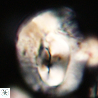 Helicosphaerella compacta VR 32709