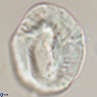 Helicosphaerella compacta VR 32701