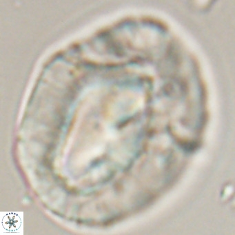 Helicosphaerella compacta VR 32702