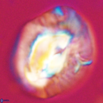 Helicosphaerella compacta VR 32703