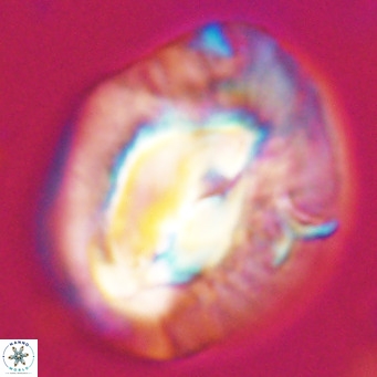 Helicosphaerella compacta VR 32703