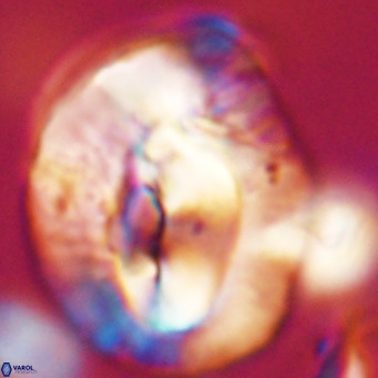 Helicosphaerella compacta VR 32710
