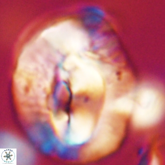 Helicosphaerella compacta VR 32710