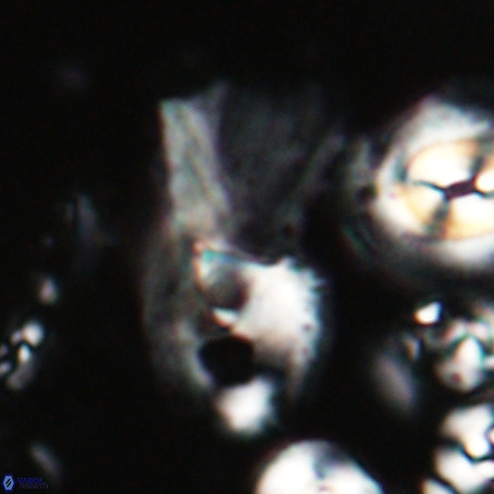 Helicosphaerella galeacristata VR 028306