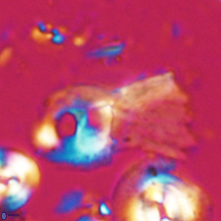 Helicosphaerella galeacristata VR 028309