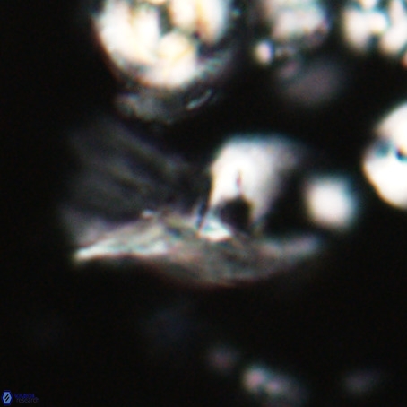 Helicosphaerella galeacristata VR 028314