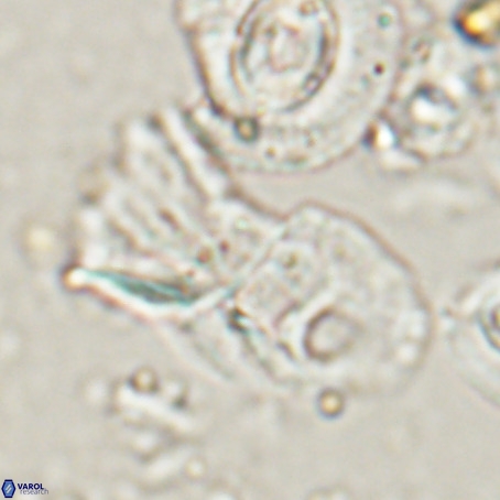 Helicosphaerella galeacristata VR 028316
