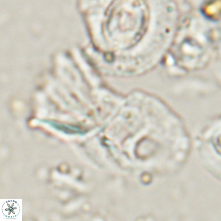 Helicosphaerella galeacristata VR 028316