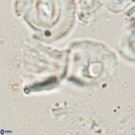 Helicosphaerella galeacristata VR 028317