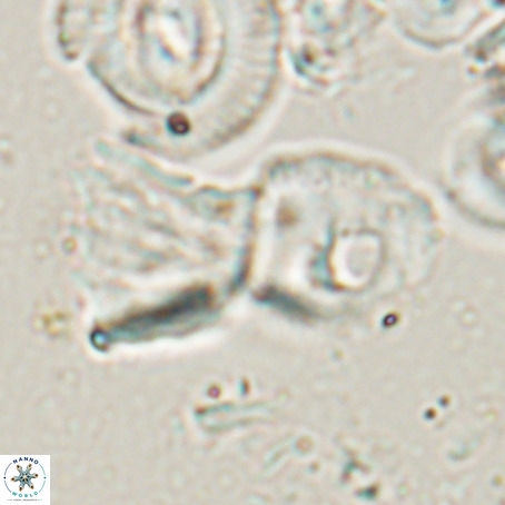 Helicosphaerella galeacristata VR 028317