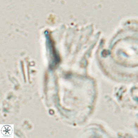 Helicosphaerella galeacristata VR 028318