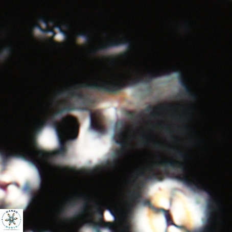 Helicosphaerella galeacristata VR 028310