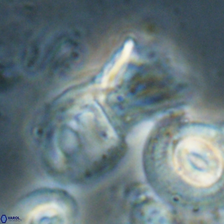 Helicosphaerella galeacristata VR 028324