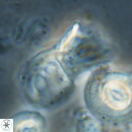Helicosphaerella galeacristata VR 028324
