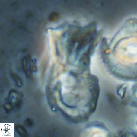 Helicosphaerella galeacristata VR 028325