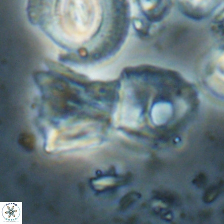 Helicosphaerella galeacristata VR 028328