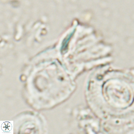 Helicosphaerella galeacristata VR 028320
