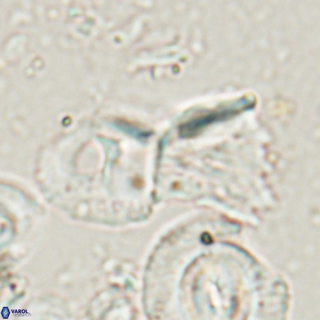 Helicosphaerella galeacristata VR 028322