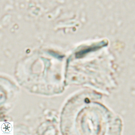 Helicosphaerella galeacristata VR 028322