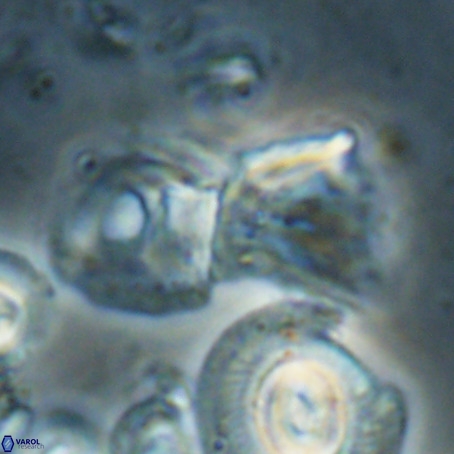 Helicosphaerella galeacristata VR 028323