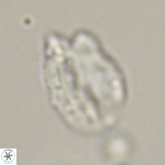 Helicosphaerella perch nielseniae VR 32722