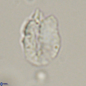 Helicosphaerella perch nielseniae VR 32723