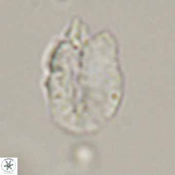 Helicosphaerella perch nielseniae VR 32723