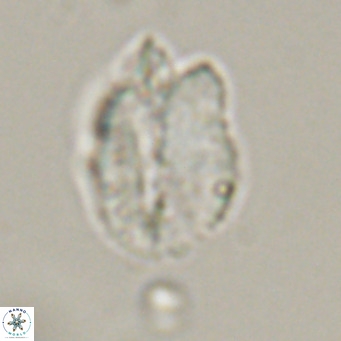 Helicosphaerella perch nielseniae VR 32724
