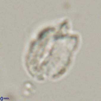Helicosphaerella perch nielseniae VR 32725