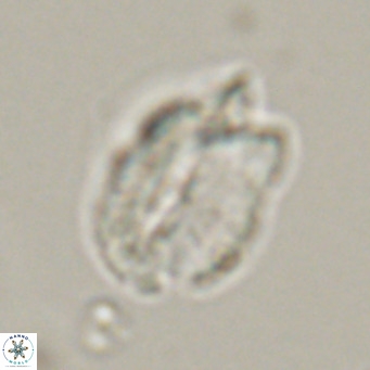 Helicosphaerella perch nielseniae VR 32725