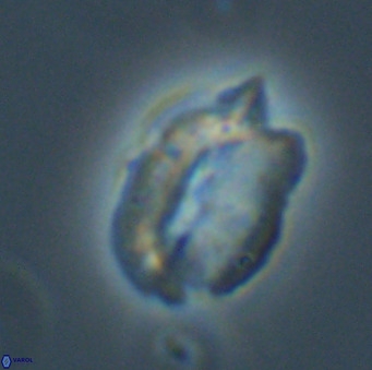 Helicosphaerella perch nielseniae VR 32726