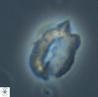 Helicosphaerella perch nielseniae VR 32726