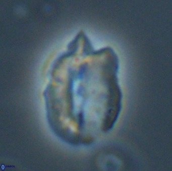 Helicosphaerella perch nielseniae VR 32727