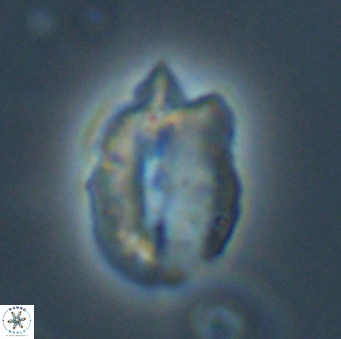 Helicosphaerella perch nielseniae VR 32727