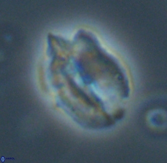 Helicosphaerella perch nielseniae VR 32728