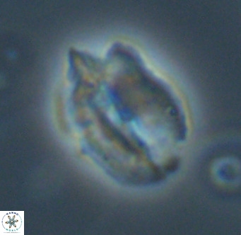 Helicosphaerella perch nielseniae VR 32728