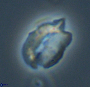 Helicosphaerella perch nielseniae VR 32729
