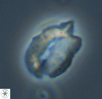 Helicosphaerella perch nielseniae VR 32729