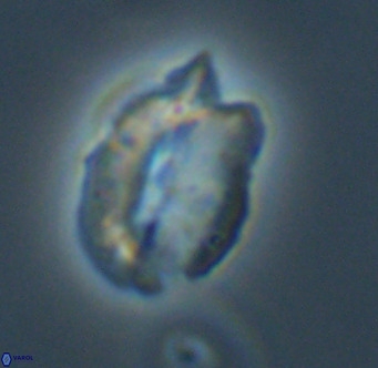 Helicosphaerella perch nielseniae VR 32730