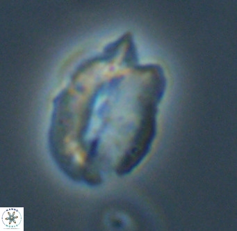 Helicosphaerella perch nielseniae VR 32730